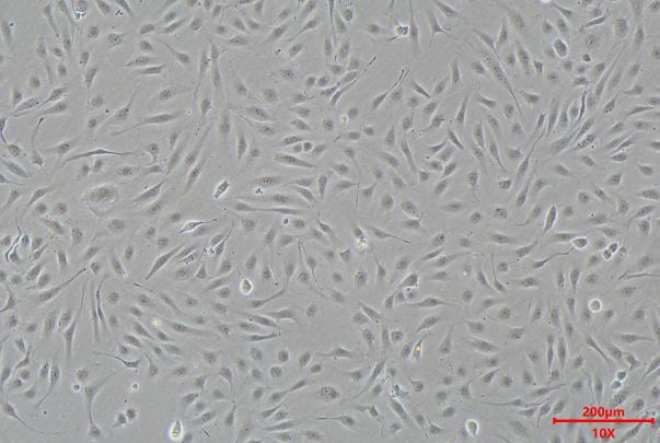 Cell Freezing Media-Serum Free :  Ensuring Stable Post-Thaw Performance of HUVECs Across Passages