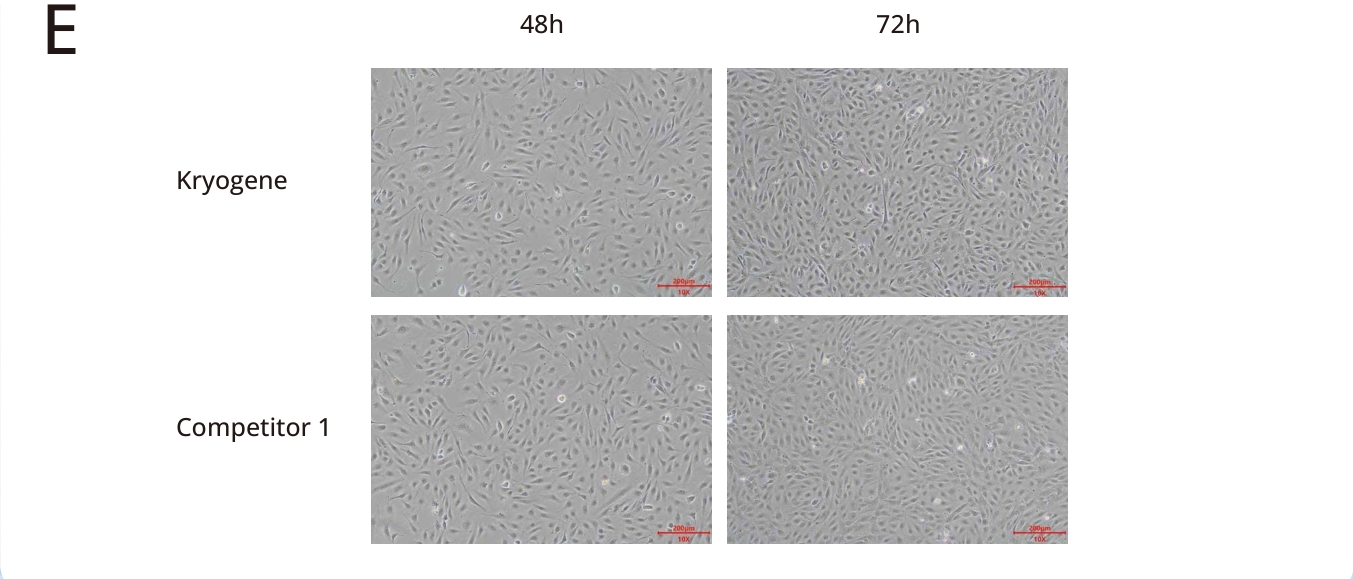 serum-free-huvec-morphology-48h-72h.jpg